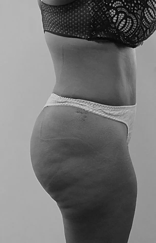 Procedure before and after - after