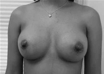 Procedure before and after - after
