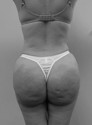 Procedure before and after - after