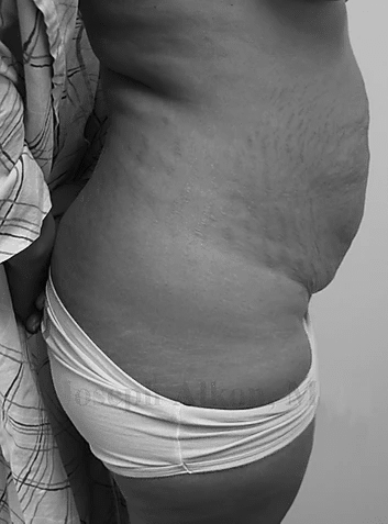 Procedure before and after - before