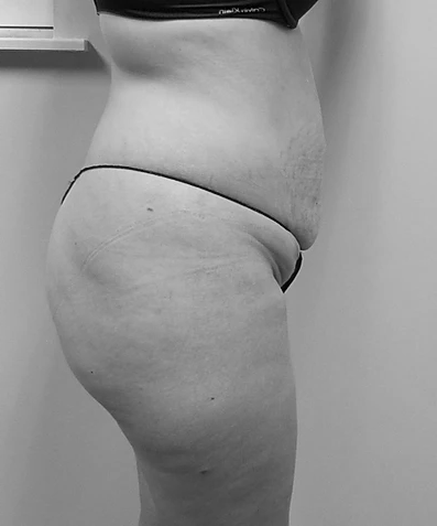 Procedure before and after - before