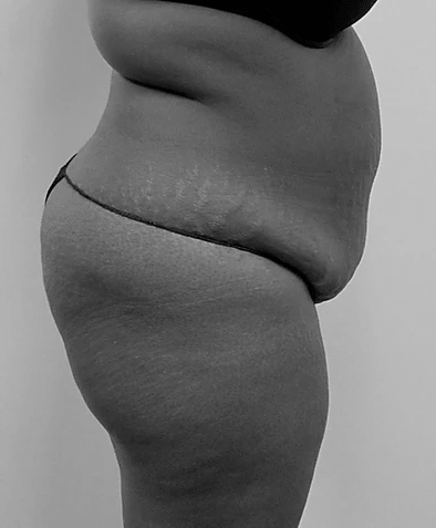 Procedure before and after - before