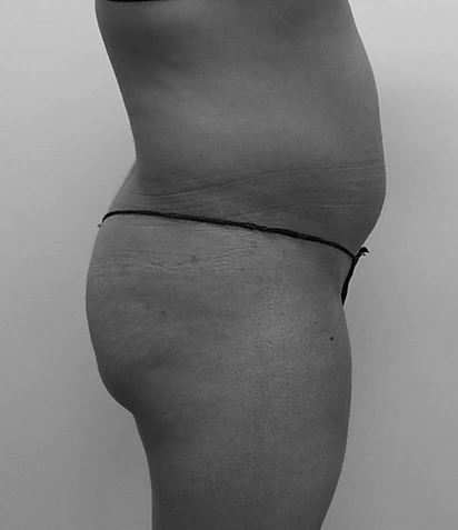Procedure before and after - before