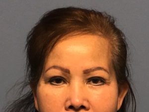 Asian Eyelid Surgery before and after - after