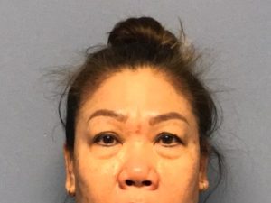 Asian Eyelid Surgery before and after - before