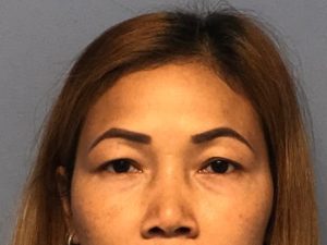 Asian Eyelid Surgery before and after - before