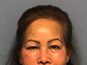 Asian Eyelid Surgery before and after - before
