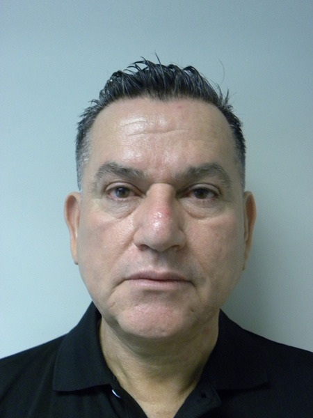 Facelift before and after - after