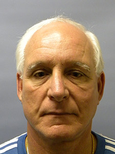 Facelift before and after - after