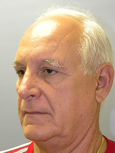 Facelift before and after - before
