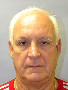 Facelift before and after - before