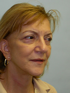 Facelift before and after - after