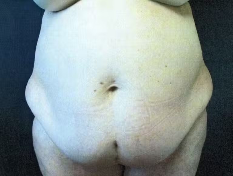 Procedure before and after - before