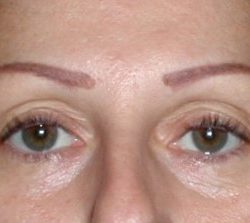 Other procedures by Dr. Mossi Salibian — before and after