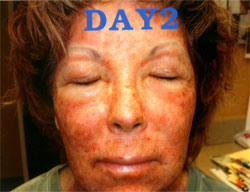 Other procedures by Dr. Mossi Salibian — before and after