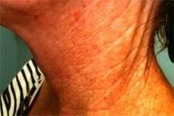 Other procedures by Dr. Mossi Salibian — before and after