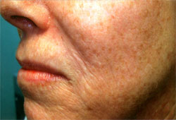 Other procedures by Dr. Mossi Salibian — before and after