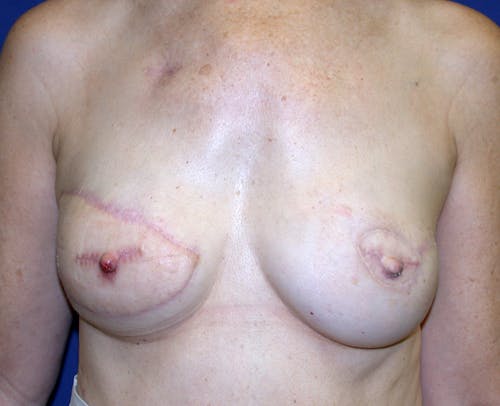 Other procedures by Dr. Abhay Gupta — after