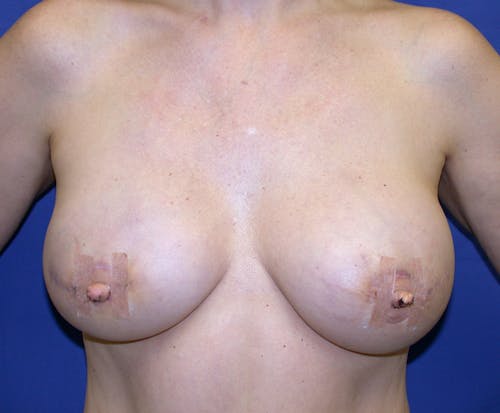 Other procedures by Dr. Abhay Gupta — after