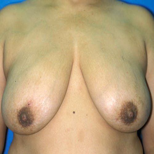 Other procedures by Dr. Abhay Gupta — before