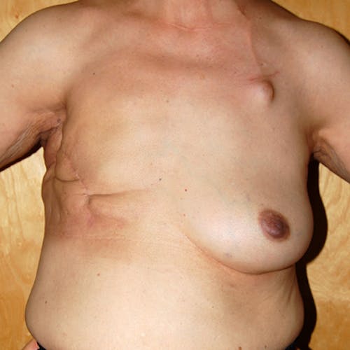 Other procedures by Dr. Abhay Gupta — before