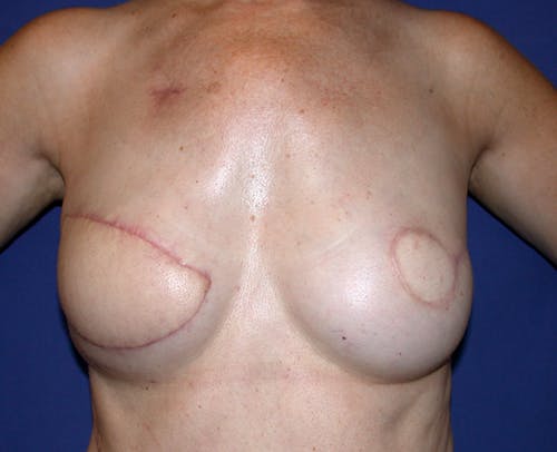 Other procedures by Dr. Abhay Gupta — before