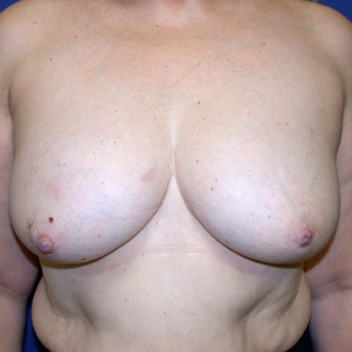 Other procedures by Dr. Abhay Gupta — before