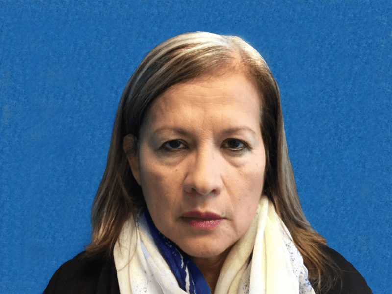 Blepharoplasty before and after - before