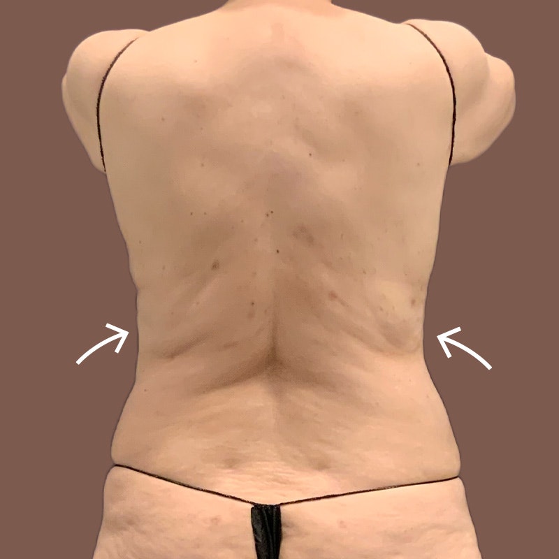 Back - AirTite before and after - after