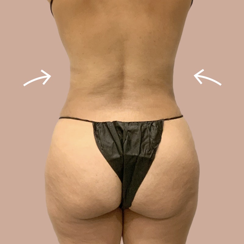 Back - AirTite before and after - after