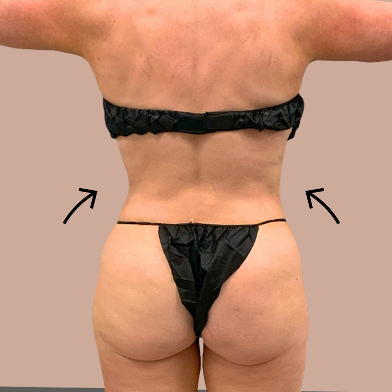 airtite back before and after - after