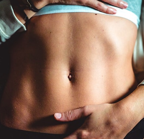 Tummy Tuck + Lipo before and after - after