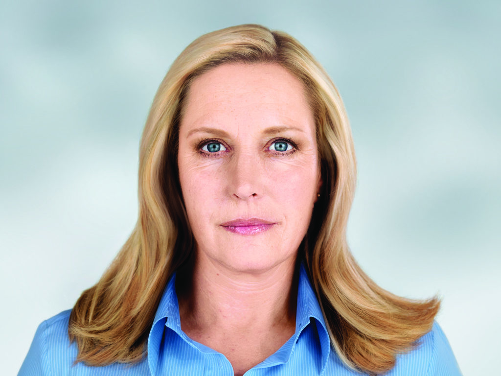 Sculptra before and after - after