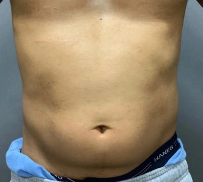 Other procedures by Dr. Kyle Song — before
