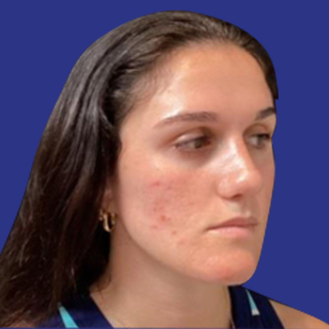 Procedure before and after - after