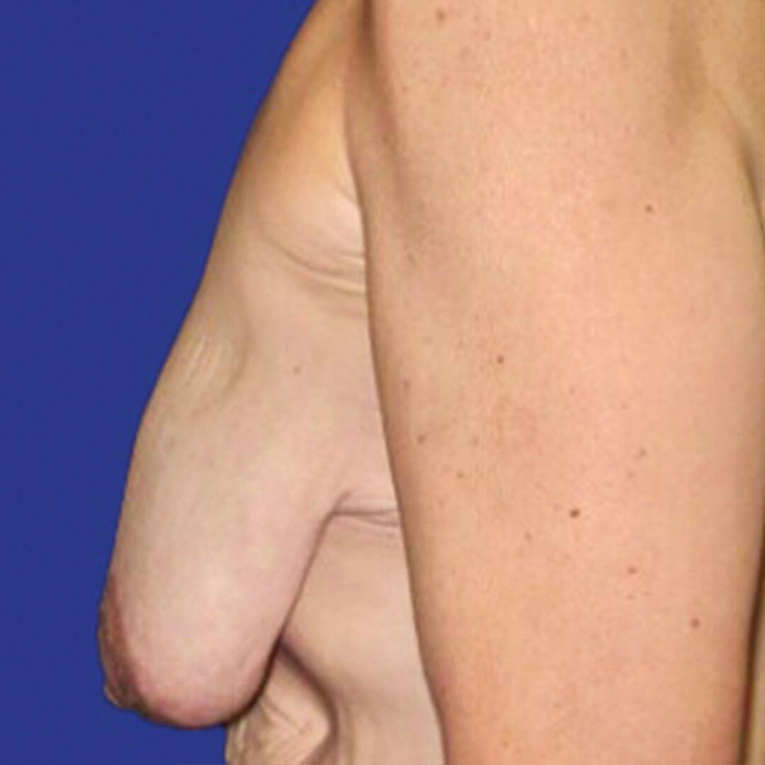 Procedure before and after - after