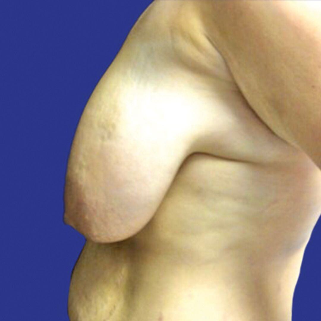 Procedure before and after - before