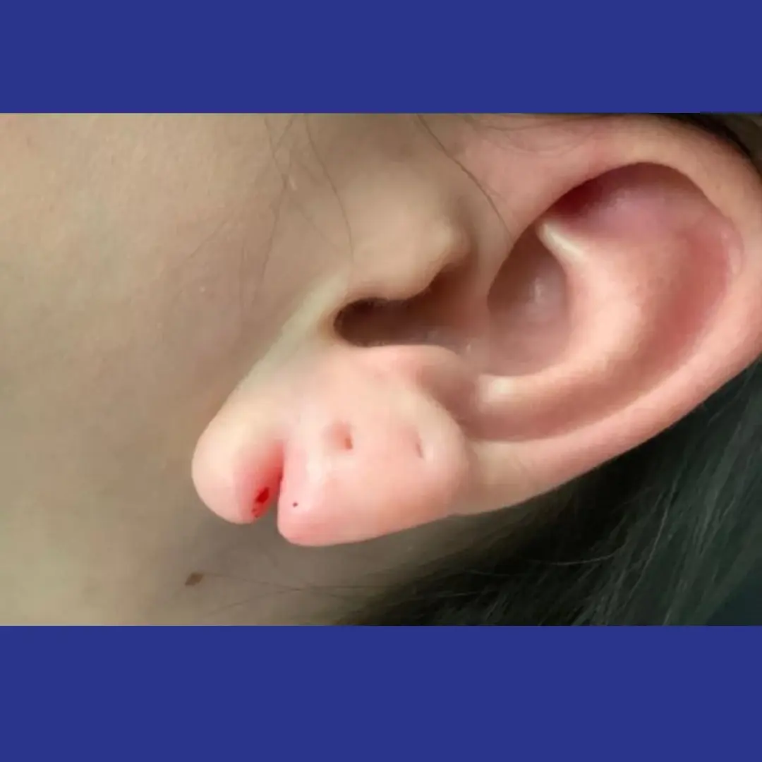 Procedure before and after - before