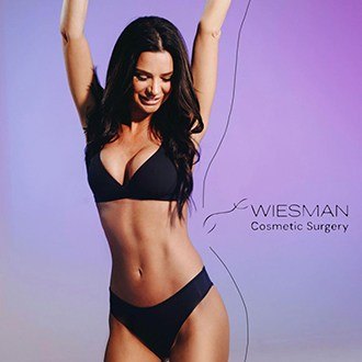 Liposuction before and after - after