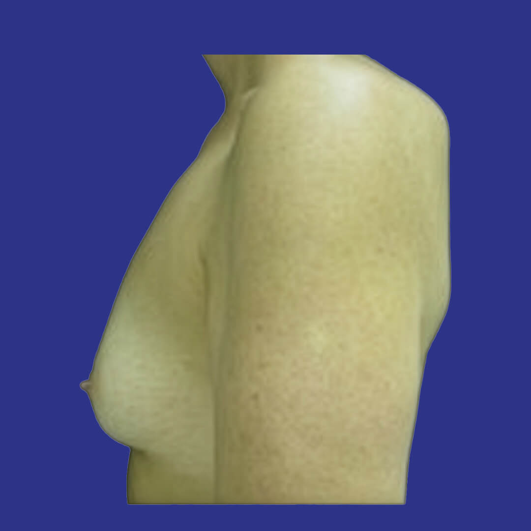 Procedure before and after - before