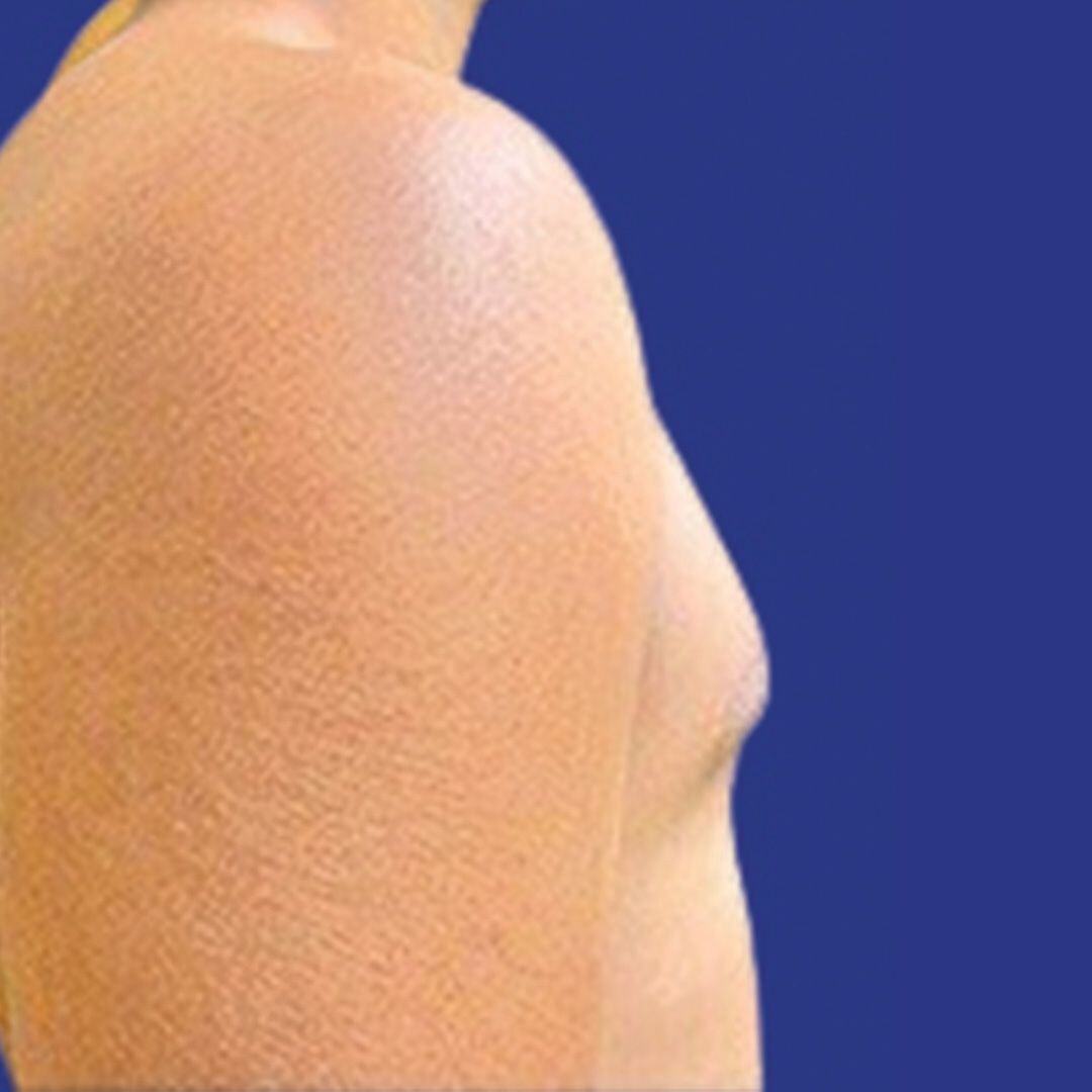 Procedure before and after - before