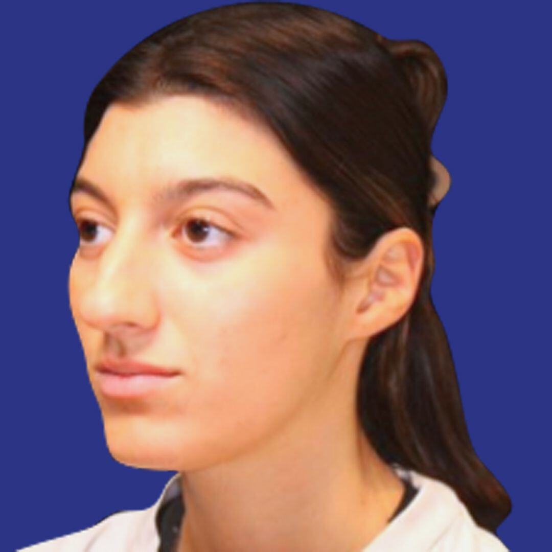 Procedure before and after - before