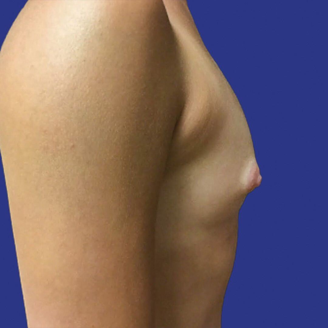 Procedure before and after - before