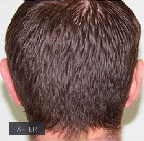Procedure before and after - after