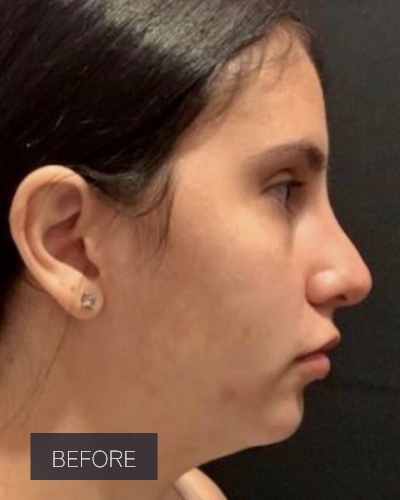 Procedure before and after - before