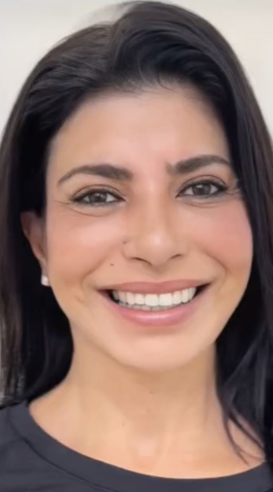 Procedure before and after - before
