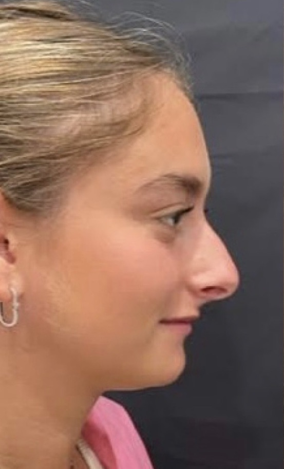 Procedure before and after - before