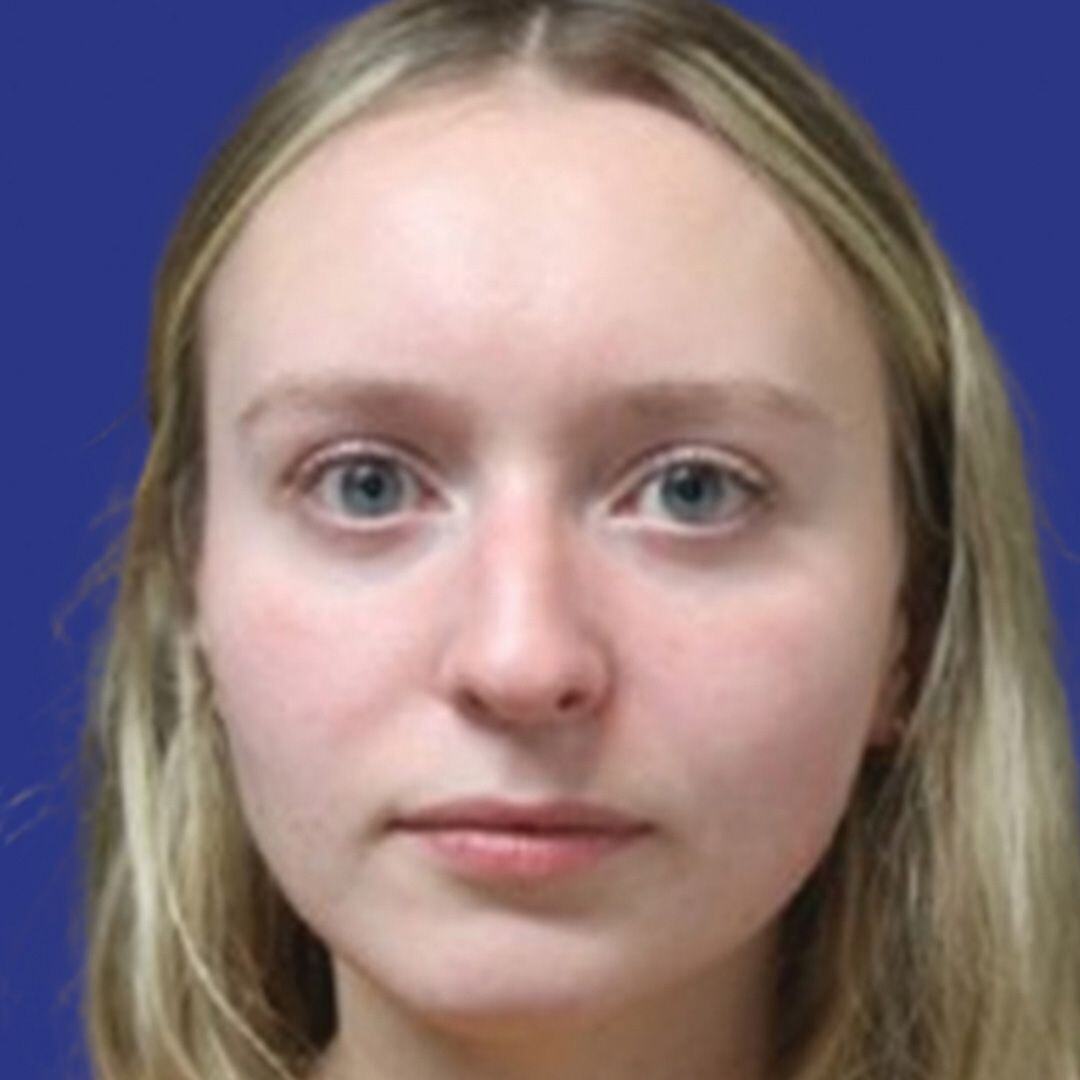 Procedure before and after - after