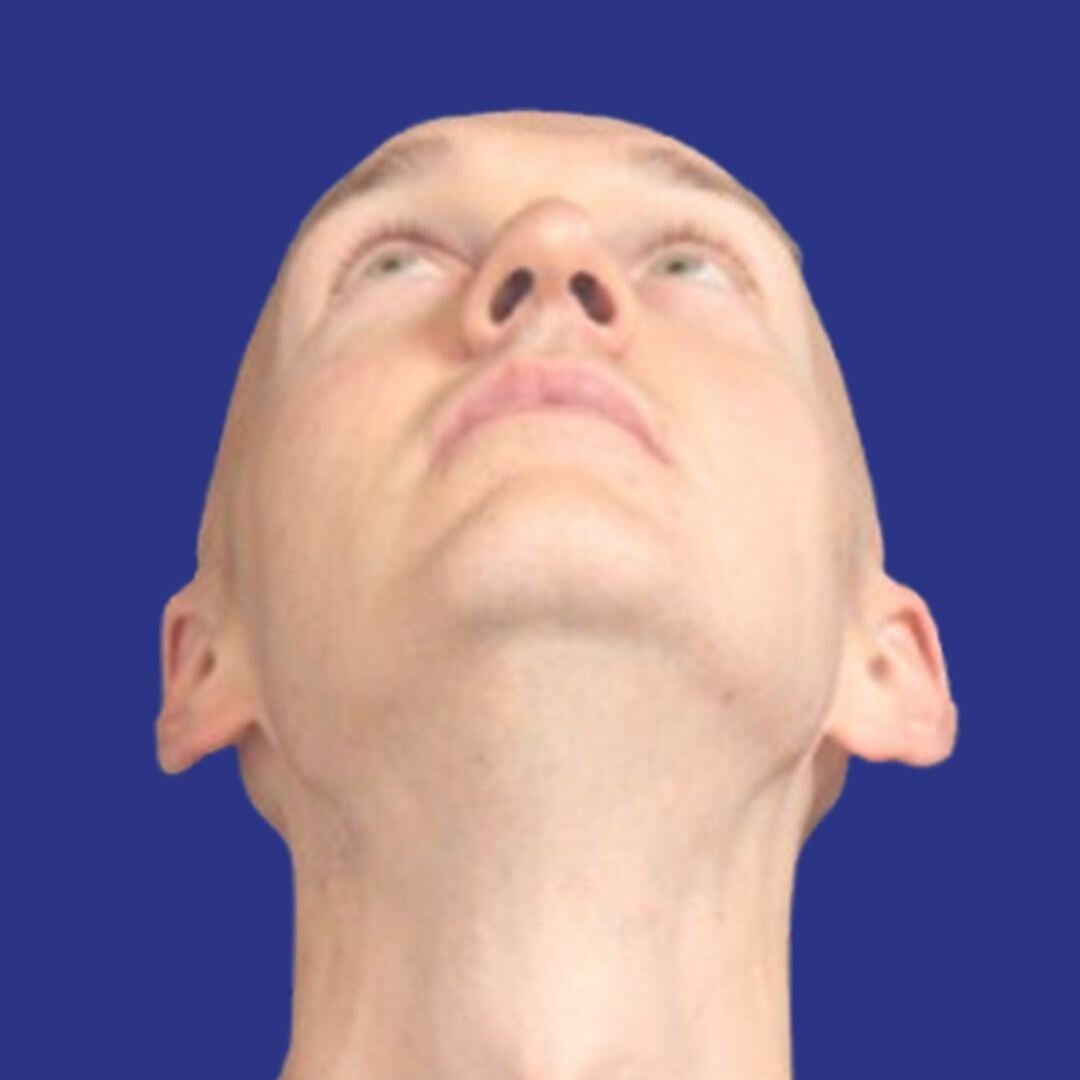 Procedure before and after - after