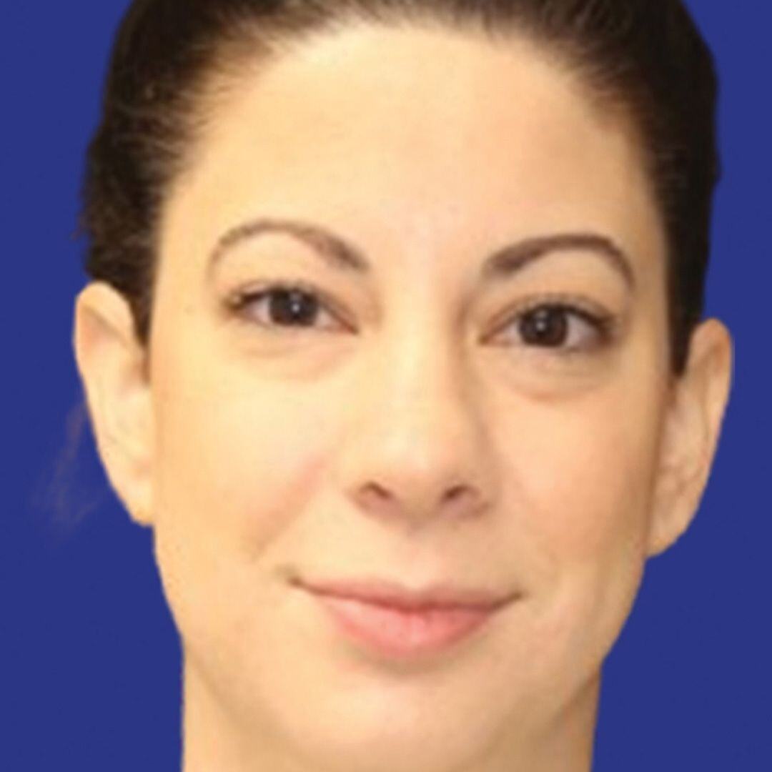 Procedure before and after - after